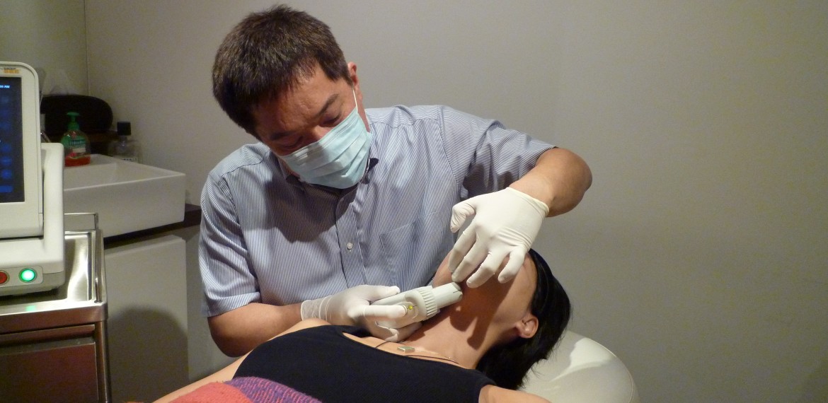 Ulthera for facial sculpting