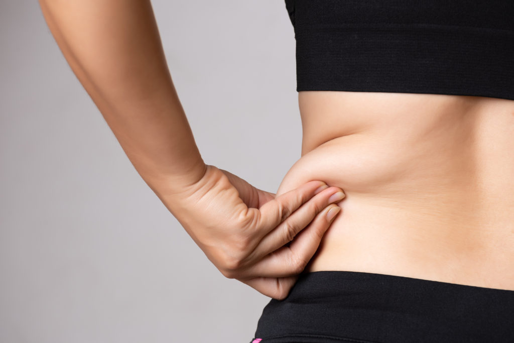 liposuction