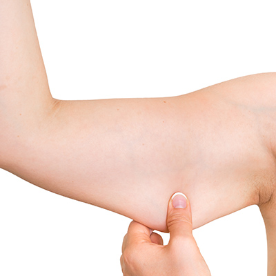 flabby_under_arms