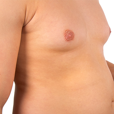 male_boobs