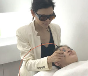 yellow laser treatment