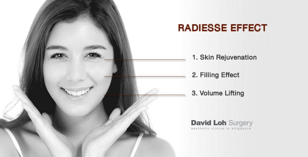 How Radiesse Works