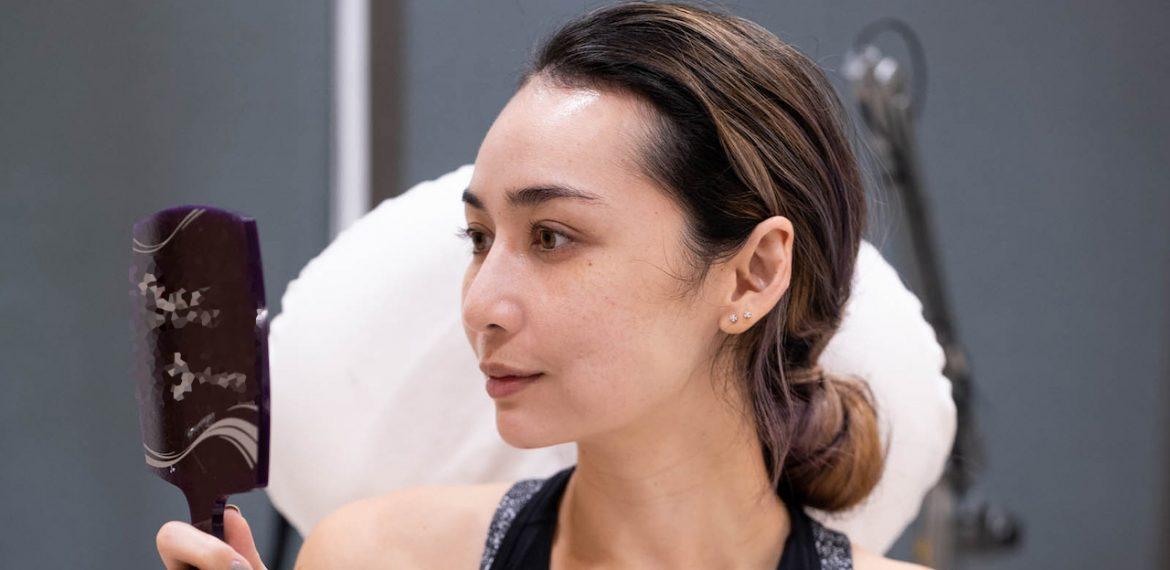 fillers_by_dr_david_loh